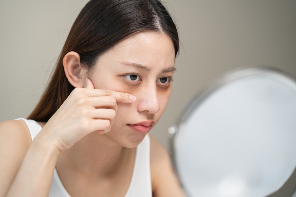 Thiếu ngủ ảnh hưởng đến làn da và ngoại hình